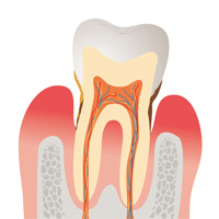 歯周病がもたらす病気